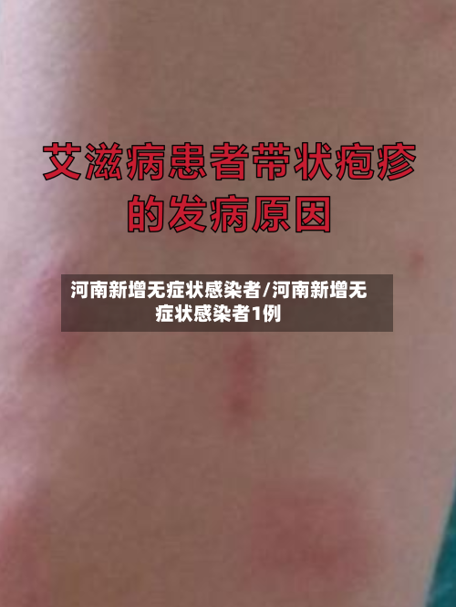河南新增无症状感染者/河南新增无症状感染者1例
